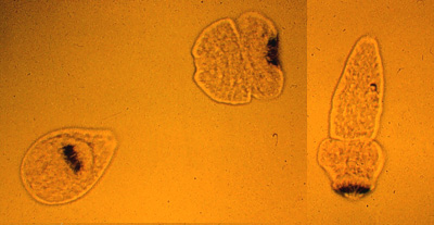 Hydatid sand