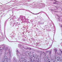 E. vermicularis in appendix cross-section