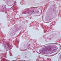 E. vermicularis eggs in appendix cross-section