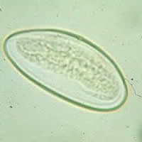 Enterobius egg