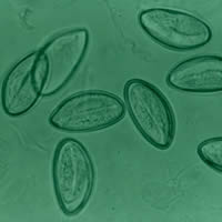 Enterobius eggs