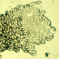 Enterobius eggs