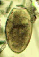 Fasciola hepatica egg, wet mount