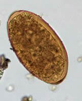 Fasciola hepatica egg, wet mount
