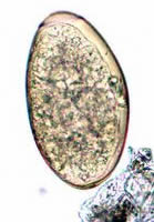 Fasciola hepatica egg, wet mount