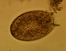 Fasciolopsis buski egg
