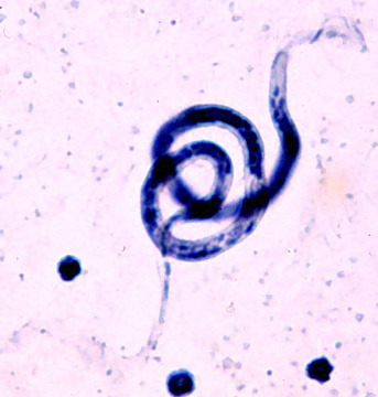 B. malayi microfilaria