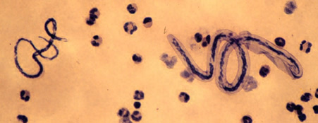 Loa loa and M. perstans microfilariae