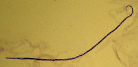 M. streptocerca microfilaria