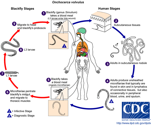 Life cycle of Onchocerca volvulus