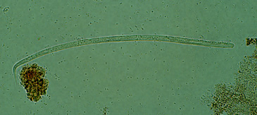 O. volvulus microfilaria