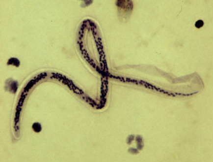 W. bancrofti microfilaria