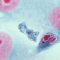 Acanthamoeba polyphaga trophozoite in tissue culture 