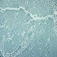 Naegleria fowleri in brain tissue