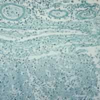 Naegleria fowleri in brain tissue