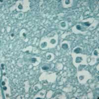 Naegleria fowleri in brain tissue