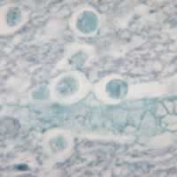 Naegleria fowleri in brain tissue