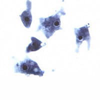 Naegleria fowleri trophozoites