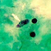 Naegleria fowleri trophozoite