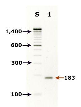 Agarose Gel - PCR for Giardia