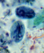 Giardia intestinalis cysts, iron hematoxylin