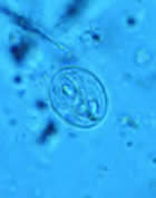 Giardia intestinalis cyst, wet mount
