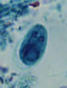 Giardia intestinalis cyst, iron hematoxylin