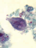 Giardia intestinalis trophozoite, trichrome
