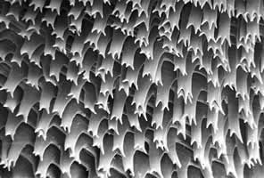 Detail of cuticular spines of the anterior body part