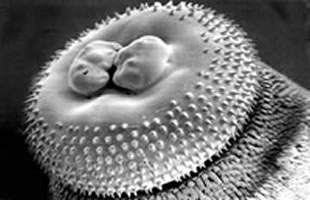 Head bulb of Gnathostoma spinigerum