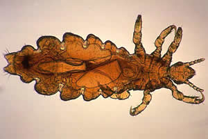 Adult female louse