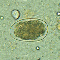 Hookworm egg 