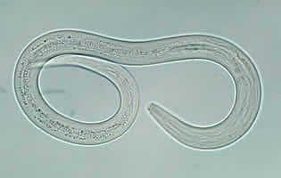 Hookworm filariform larva 