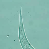 Hookworm filariform larva tail