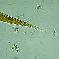 Hookworm filariform larva tail