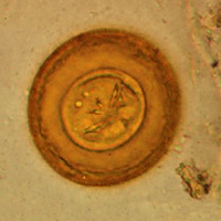 Hymenolepis diminuta egg