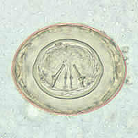 Hymenolepis diminuta egg