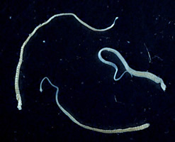 Three adult Hymenolepis nana tapeworms