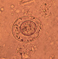 Hymenolepis nana egg