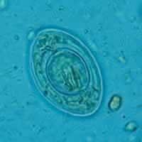 Hymenolepis nana egg