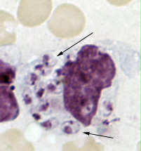 Leishmania tropica amastigote