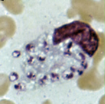 Leishmania tropica amastigote