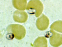 Leishmania amastigotes