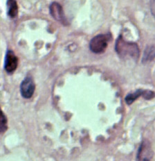 Leishmania mexicana in skin