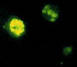 Positive malaria IFA