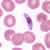 Gametocytes of P. falciparum in a thin blood smear
