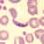 Gametocytes of P. falciparum in a thin blood smear