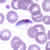 Gametocytes of P. falciparum in a thin blood smear