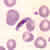 Gametocytes of P. falciparum in a thin blood smear