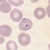 Rings of P. falciparum in a thin blood smear